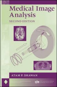 Medical Image Analysis second edition